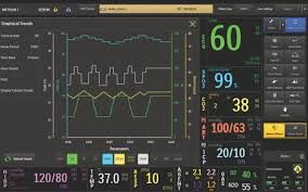 Invivo Expression IP5