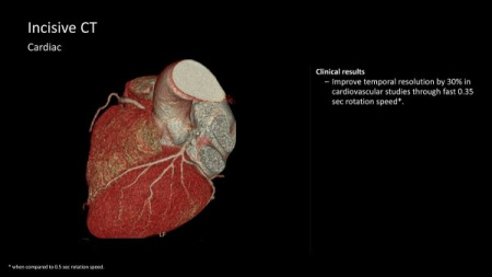 Incisive CT