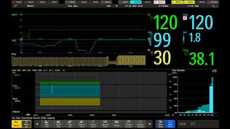 IntelliVue MX800