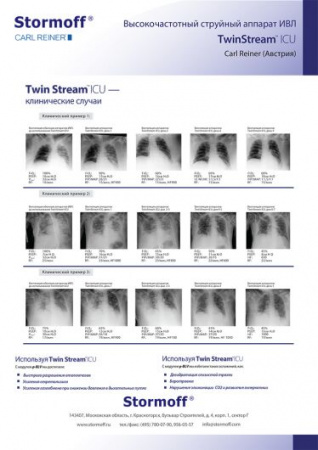 TwinStream