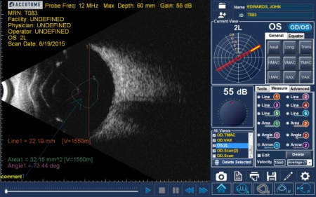 B-scan Plus