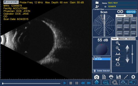 B-scan Plus