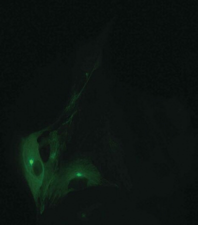DS-Qi2