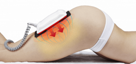 Lipo Infralight