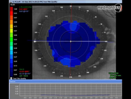 Medmont E300 USB