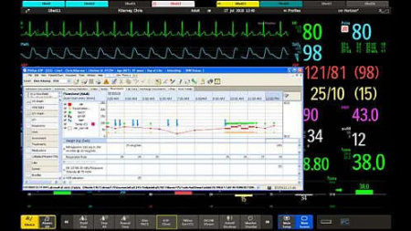 IntelliVue MX800